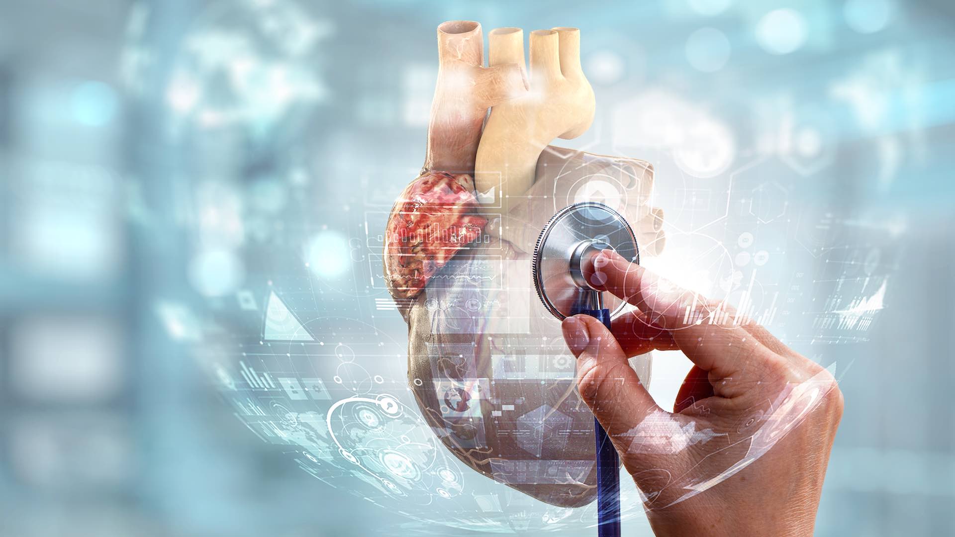 ผู้เชี่ยวชาญสรุปกลยุทธ์สำคัญในการต่อสู้กับการแพร่ระบาดของอาการหัวใจวาย